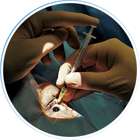 Invasive Eye Injections